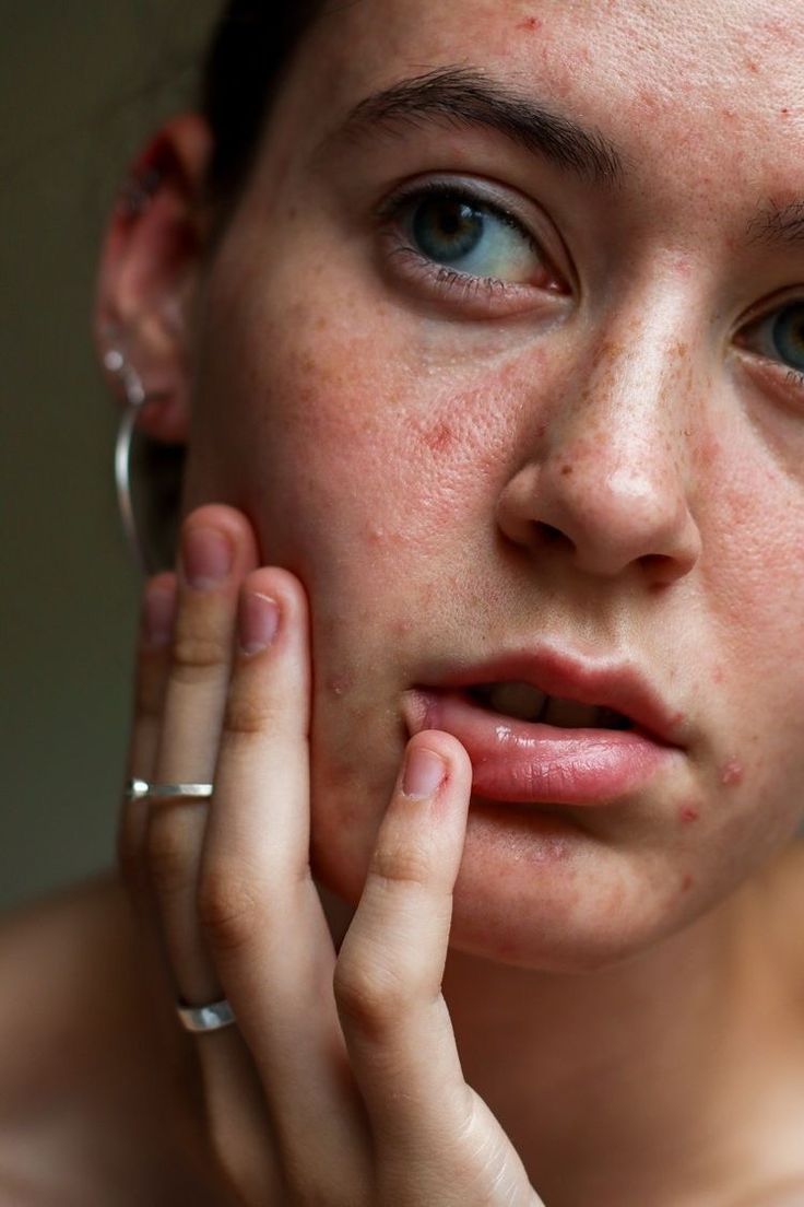 schema-face-mapping-signification-emplacement-boutons-visage