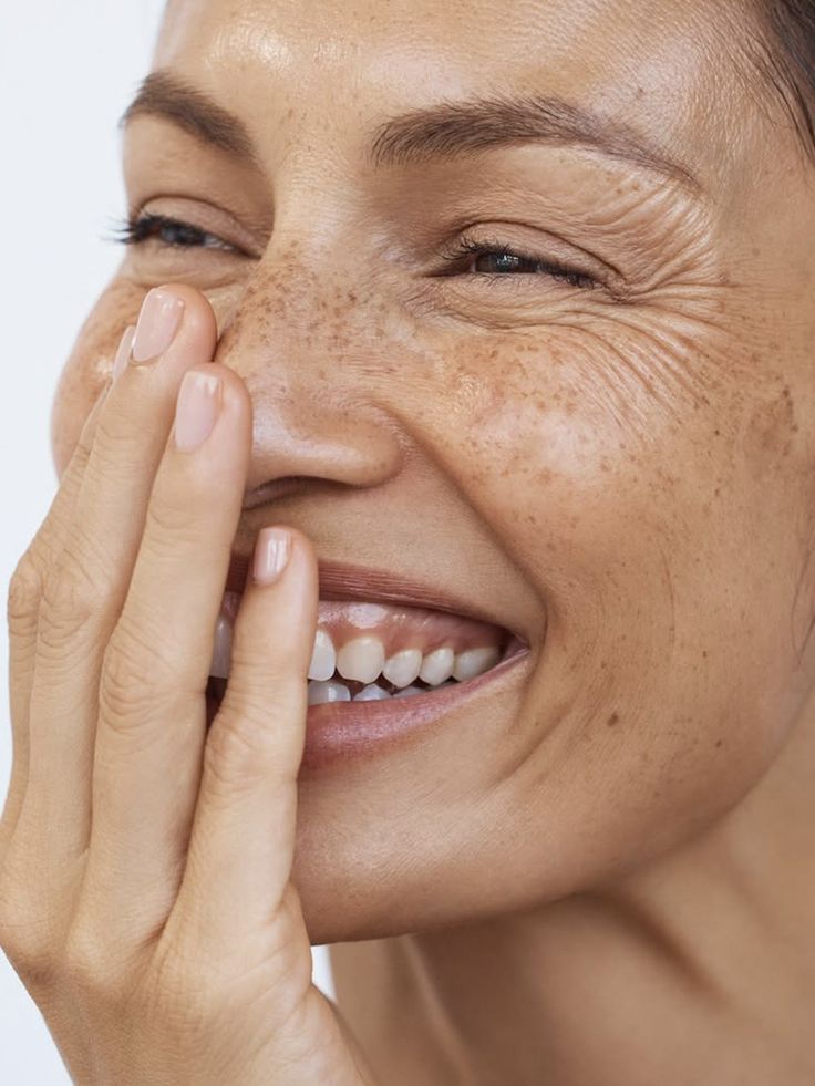 Taches pigmentaires : décryptage de ces marques du temps